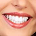 /album/fotos/sorriso2-jpg1/